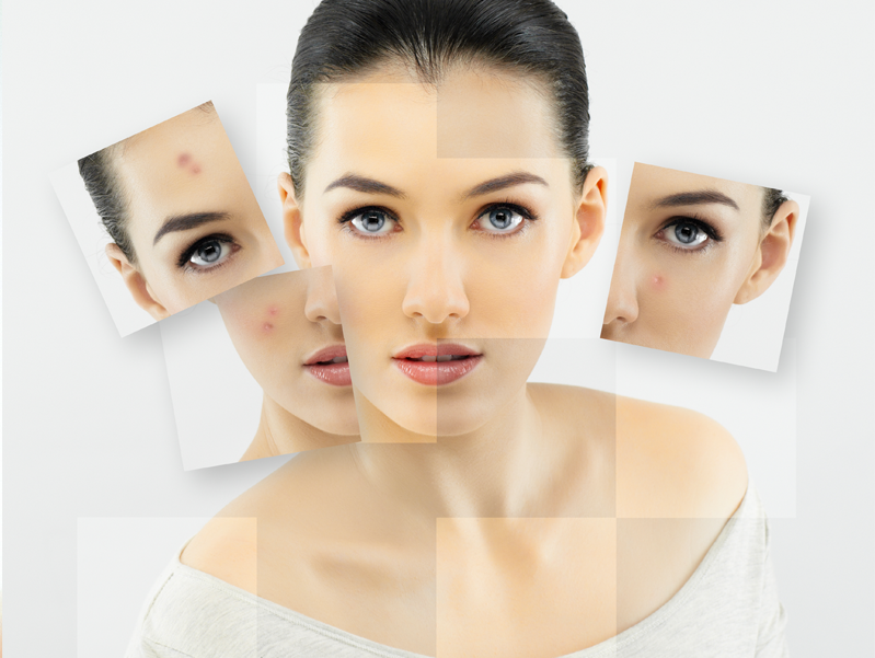 hand and legs laser hair removal