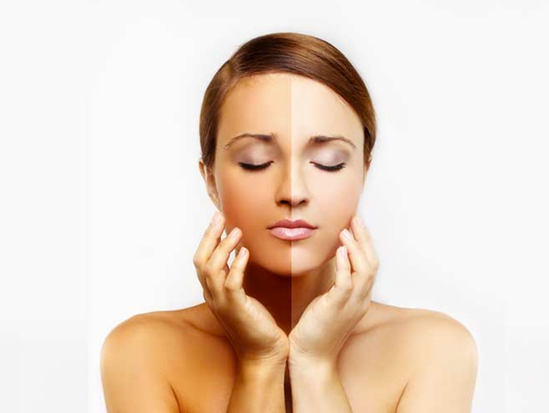Skin tightening treatments