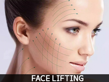 face lift